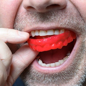 Man removing red mouthguard from upper arch