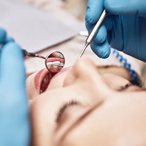 Closeup of woman’s teeth reflected in dental mirror during examination