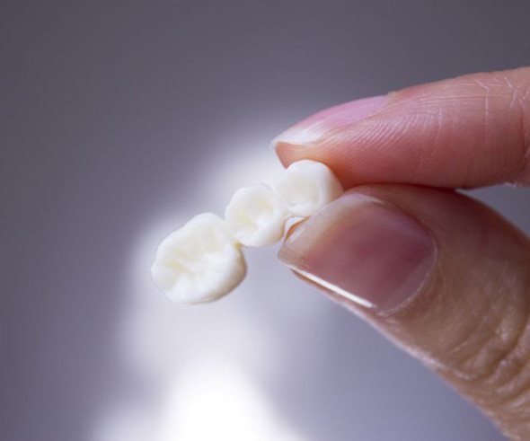 Two fingers carefully holding a dental bridge