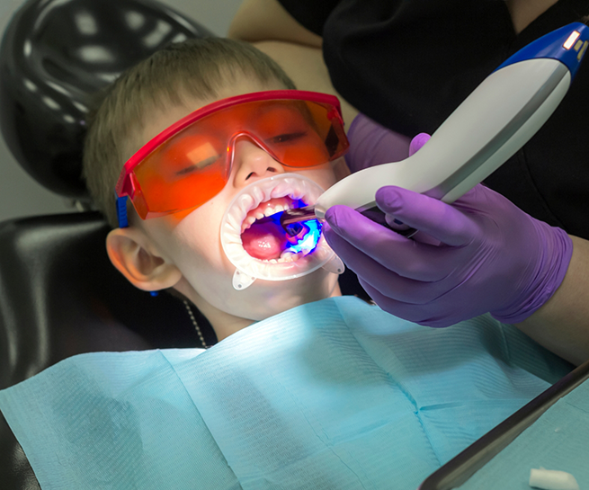 Young boy having dental sealants placed on his teeth