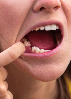 Dentist holding Invisalign aligners