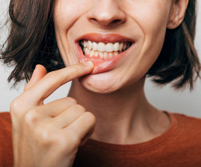 Close up of a woman pointing to her gums