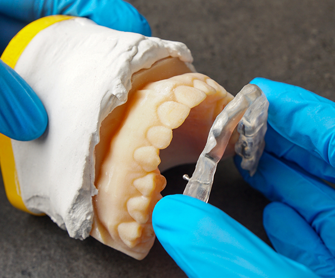 Dentist placing a clear tray over a row of teeth in a model of the jaws