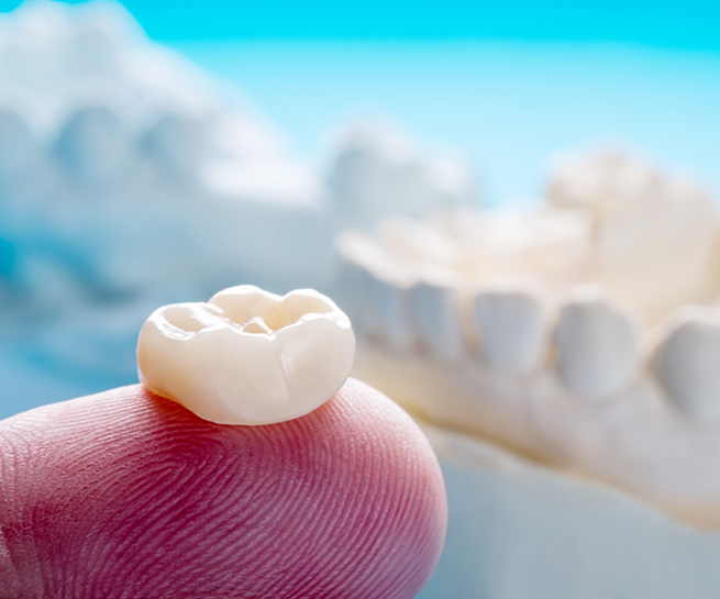 Close up of a dental crown resting on a finger