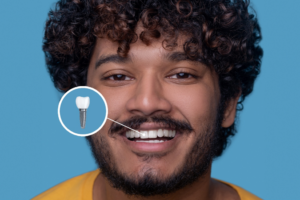 a patient with dental implants smiling